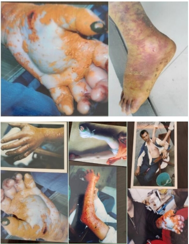 弘扬劳模精神 争当时代先锋 访黄山市徽州毒蛇研究所所长---汪炳炎