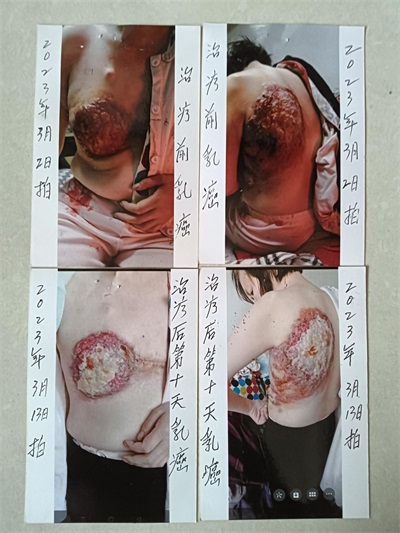 杨宗仙：  中医传承创新领路人，  为民治病写下传奇故事