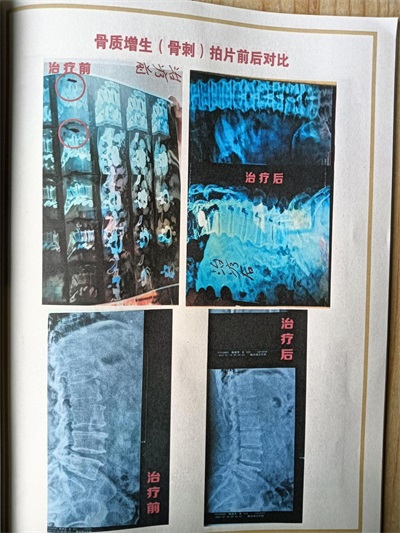 杨宗仙：  中医传承创新领路人，  为民治病写下传奇故事