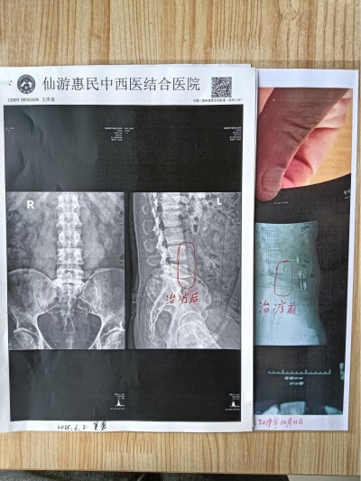 杨宗仙：  中医传承创新领路人，  为民治病写下传奇故事