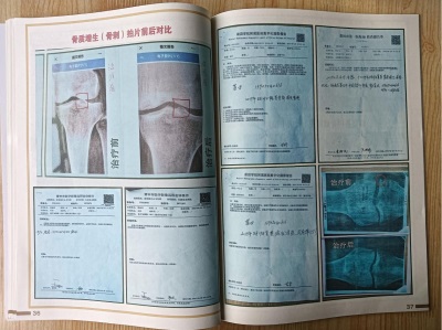 杨宗仙：  中医传承创新领路人，  为民治病写下传奇故事