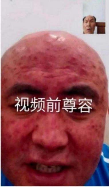 现代医疗手段与古代中医文化》 一一 疗效才是硬道理一一