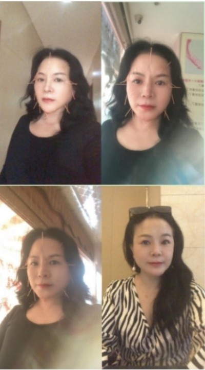 恭贺著名中医针灸非遗传承人邓国珍被央视在线直播网特聘为客座教授