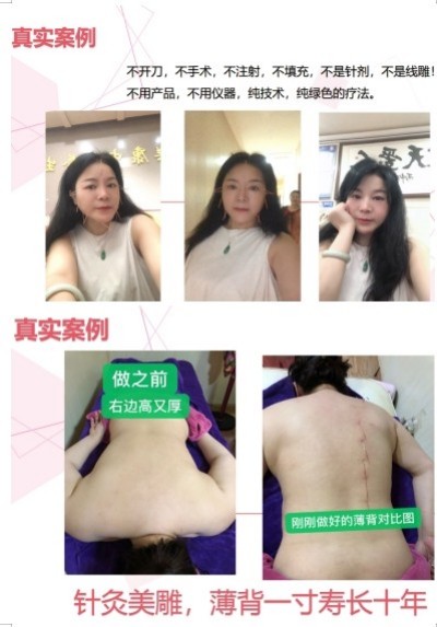 恭贺著名中医针灸非遗传承人邓国珍被央视在线直播网特聘为客座教授