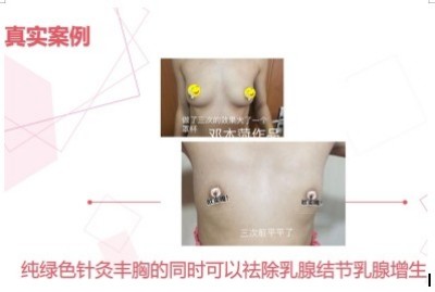 恭贺著名中医针灸非遗传承人邓国珍被央视在线直播网特聘为客座教授